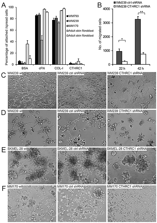 Effect of CTHRC1 on cell adhesion, migration, and invasion.