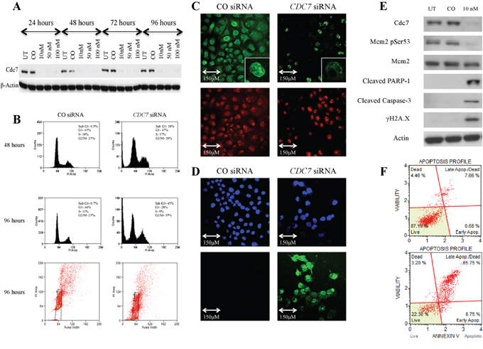 Knockdown of CDC7 mRNA in PANC-1 pancreatic adenocarcinoma cells following transfection with custom siRNA.