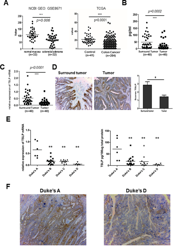 Decreased tumoral TSLP expression in human colon cancer.