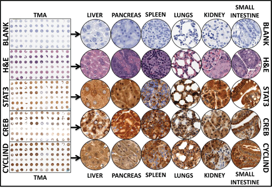 Representative images of the tissue microarray constructed with the replicates of the Liver, pancreas, lungs, kidney, spleens, and small intestine from mice with favorable neuroblastoma and mice with high-risk metastatic disease.