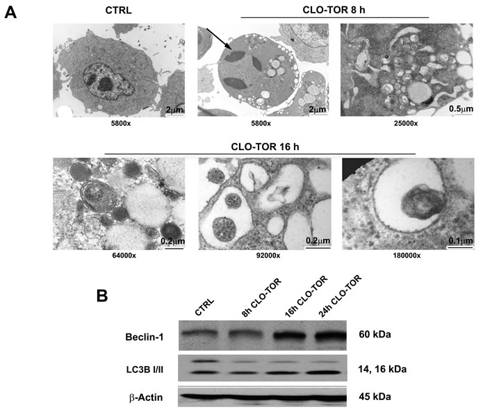 CLO-TOR induces autophagy in MOLM-13 cells.