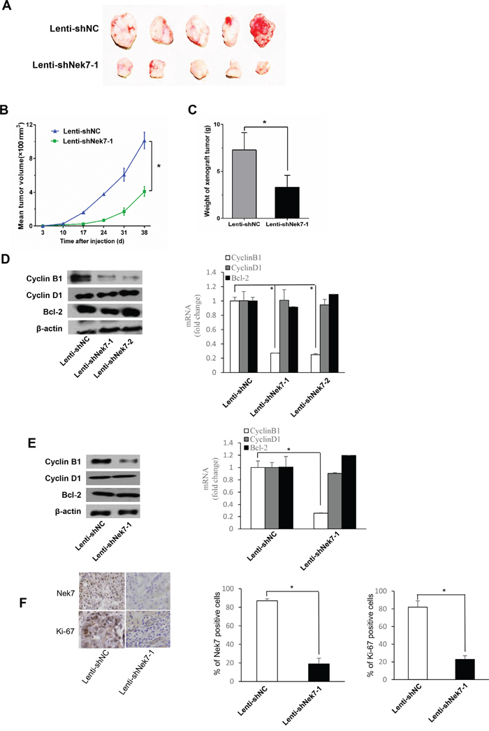 Nek7 gene silencing suppressed growth of SMMC7721 xenograft tumors.