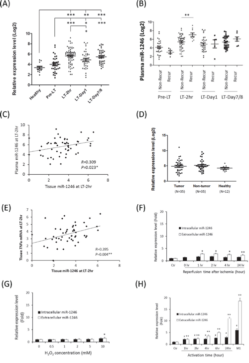 The expression analyses of miR-1246 in liver transplantation of HCC recipients and in in vitro models.