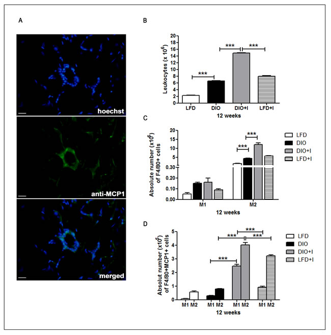 Increased number of M2- phenotype macrophages and its MCP-1 production are induced by diet and exacerbated by