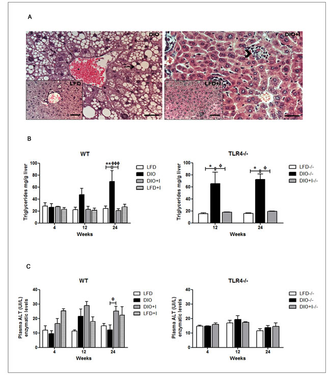 Non-alcoholic fatty liver disease in DIO model is modulated by