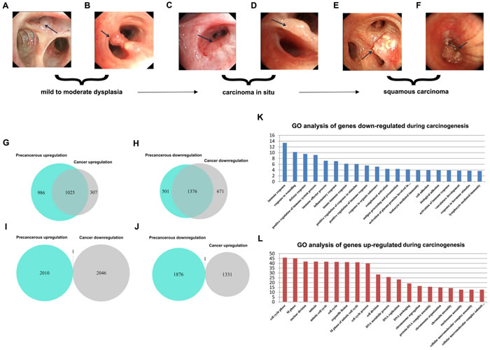 Identification of consistent DEGs and GO enrichment analysis.