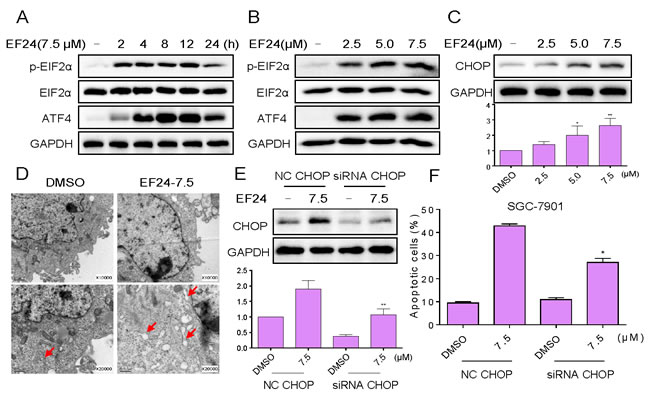 EF24 activates ER stress, which contributes to EF24 lethality in gastric cancer cells.
