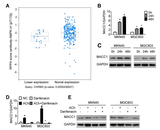 MACC1 expression is regulated by ACh and M3R.