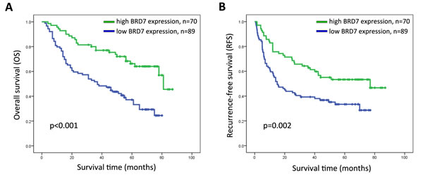 Kaplan-Meier survival curves for HCC patients after hepatectomy according to BRD7 expression.