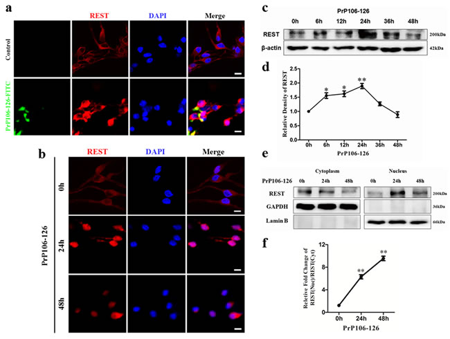 PrP106-126 induces REST expression and translocation from cytoplasm to nucleus.