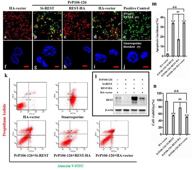 REST is neuroprotective in response to PrP106-126-induced neuronal death.
