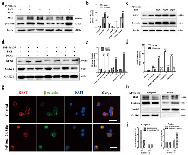 Regulation of REST by the Wnt-&#x3b2;-catenin signaling pathway.