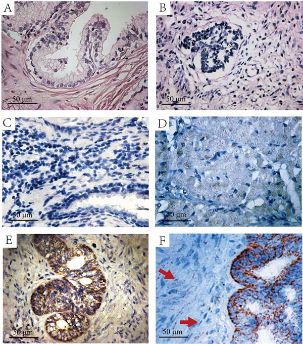 The H&amp;E and immunohistochemistry staining of HIF-l&#x3b1; in normal prostate and fetal prostate tissues.