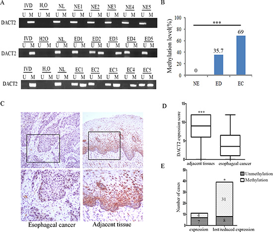 The methylation and expression status of DACT2 in primary esophageal cancer.