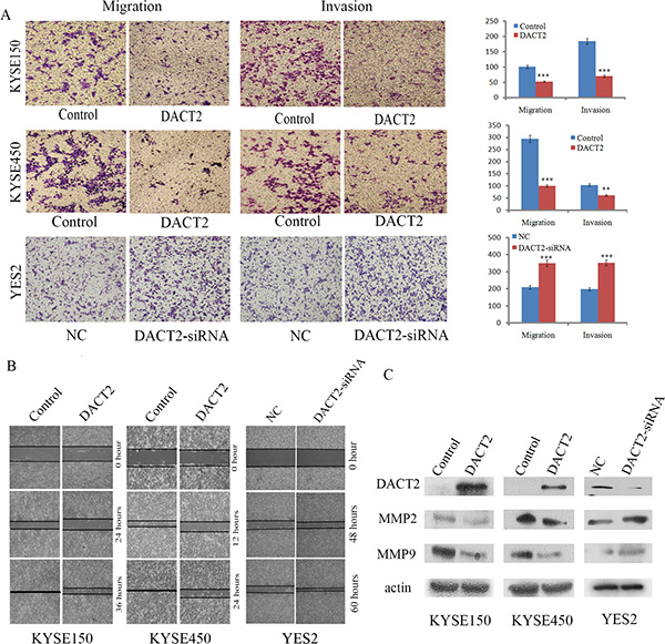 DACT2 suppresses esophageal cancer cell invasion and migration.