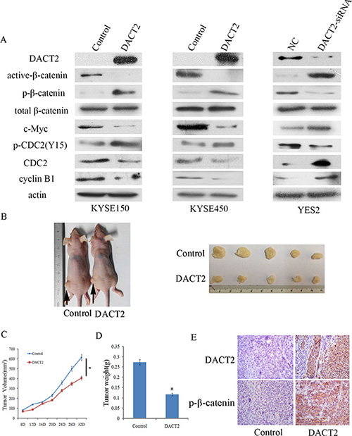 DACT2 inhibits Wnt signaling in esophageal cancer cell lines and a xenograft mouse model.