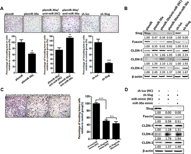 miR-30a decreases the invasiveness of breast cancer cells.