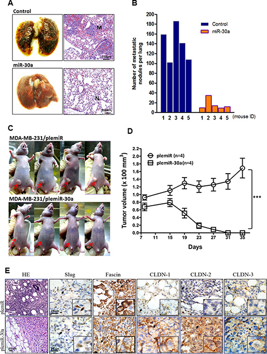 Ectopic expression of miR-30a inhibits tumor growth and metastatic lung colonization of breast cancer xenografts.