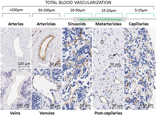 Types of blood vessels stained with immunohistochemistry anti-CD31 in neuroblastoma samples.