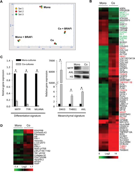 Fibroblasts induce global gene expression changes in melanoma cells.