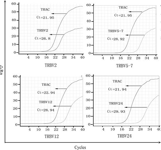 The PCR amplification curve of differential expression of TRBV in tumor lesions.