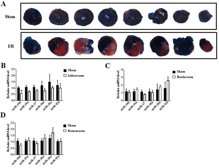 miR-19b is decreased in infarct area of myocardial ischemia-reperfusion mice.