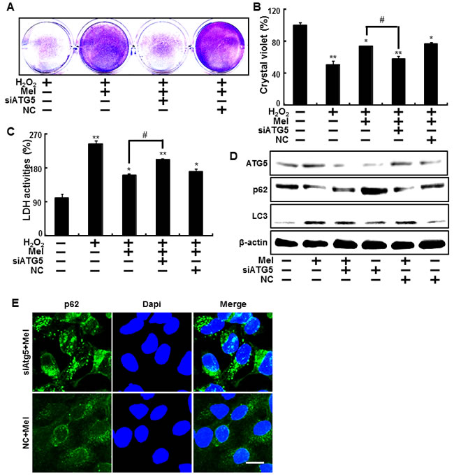 Inhibition of autophagy using ATG5 siRNA to counteract melatonin-related autophagy increases.