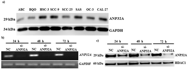 Immunoblot analysis of ANP32A expression.
