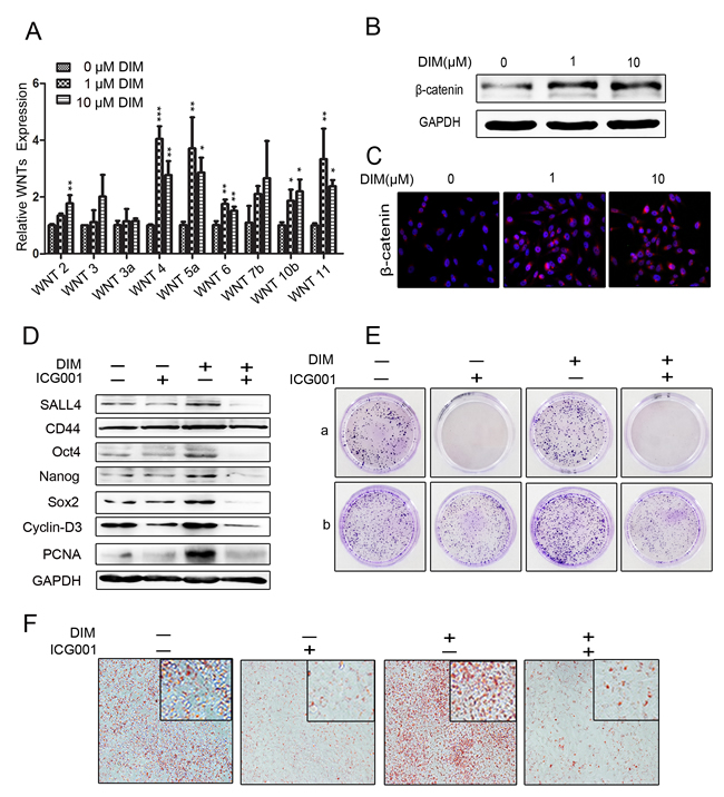 Low level of DIM activates &#x3b2;-catenin signaling to promote gastric cancer progression.