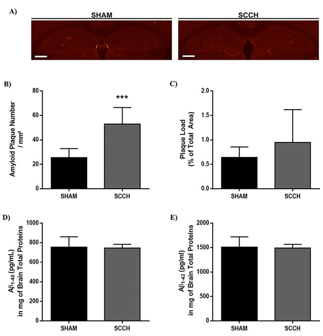 Number of A&#x3b2; plaques increases following SCCH without affecting soluble A&#x3b2; levels.
