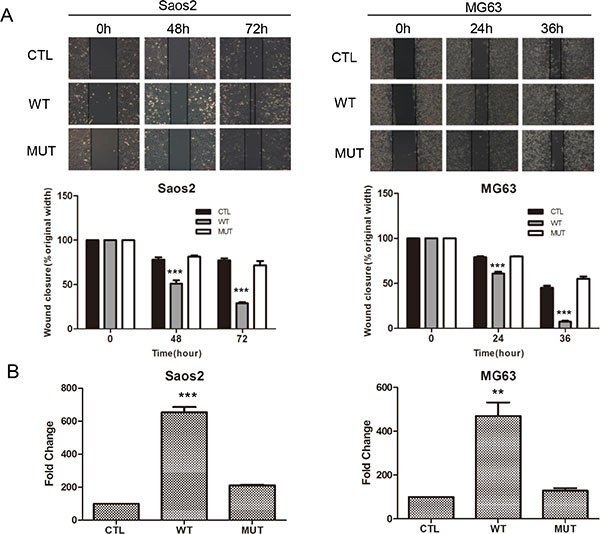 Overexpression of PLA2G16 enhances osteosarcoma cell migration and invasion.