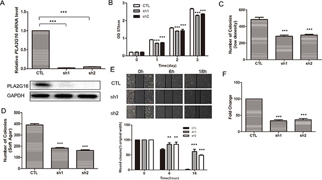 Knockdown of PLA2G16 decreases osteosarcoma cell proliferation, clonogenicity, anchorage-independent colony formation, migration and invasion.