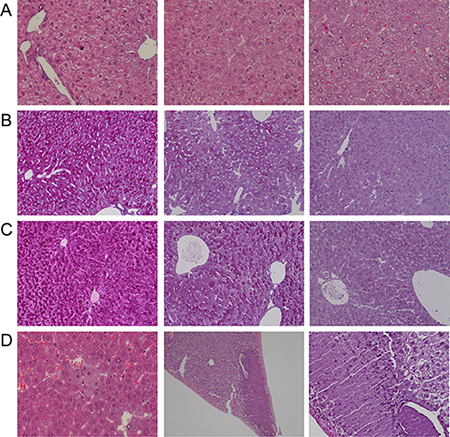 Hematoxylin-eosin and PAS staining of liver sections of Diclofenac treated mice.