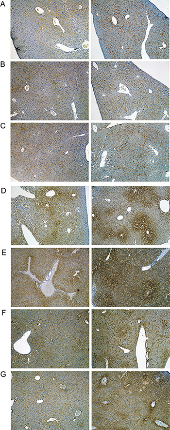 Immunohistochemistry of CD68 in livers of control and diclofenac treated mice.