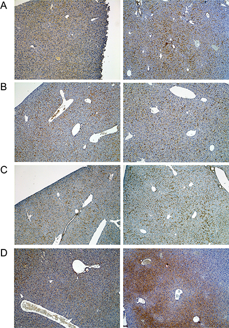 Immunohistochemistry of fibronectin in livers of control and diclofenac treated mice.