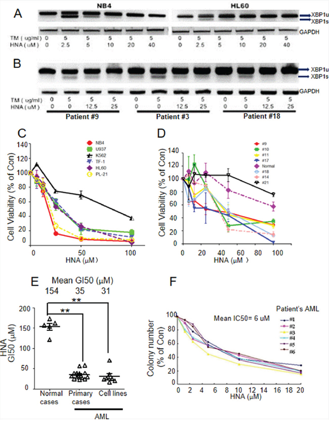 HNA inhibits XBP1s and causes cytotoxicity of AML cells.