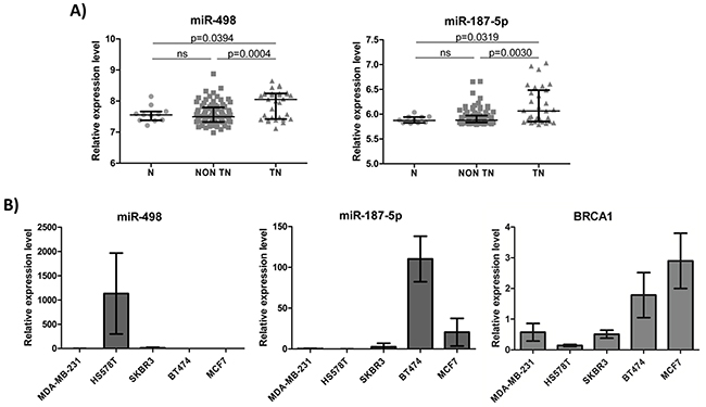 miR-498 and miR-187-5p expression levels in breast tumors and breast cancer cell lines of different subtypes.