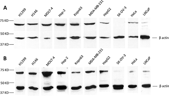 Analysis of tumor cell lines for CAPER&#x03B1; expression.