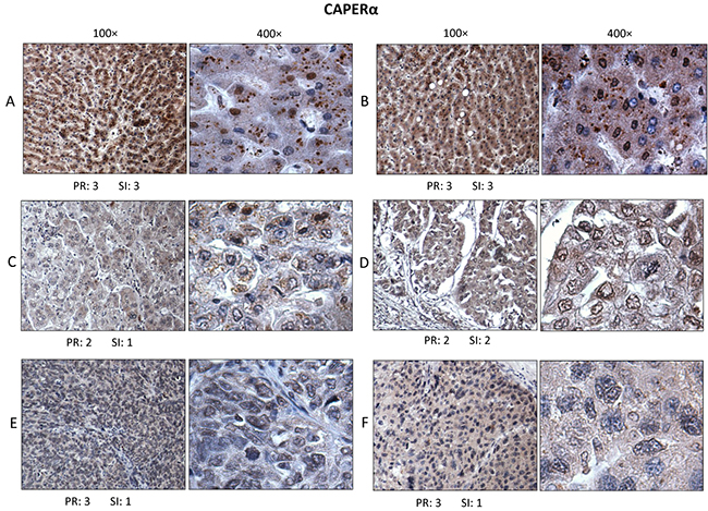 Immunohistochemistry to determine expression and localization of CAPER&#x03B1;.