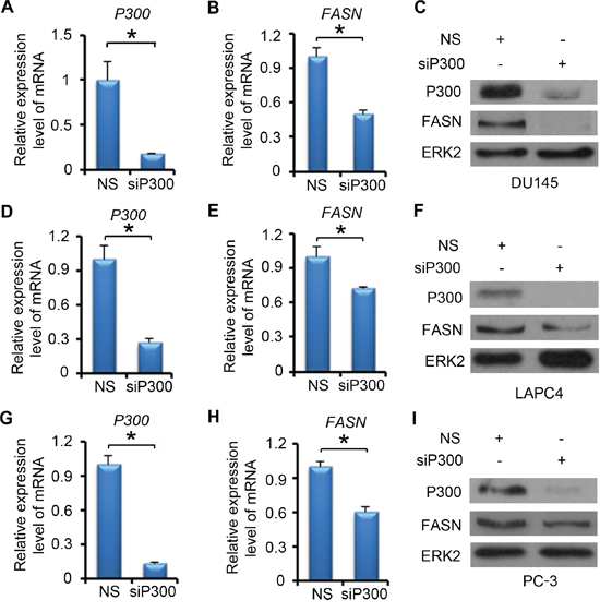 P300 regulates the expression of FASN mRNA and protein.