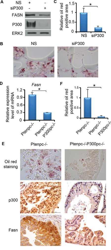 P300 affects the lipid accumulation in PCa both in vitro and in vivo.