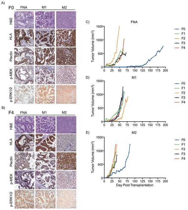 FNA-PDX and metastatic-PDX tumor growth and morphology.