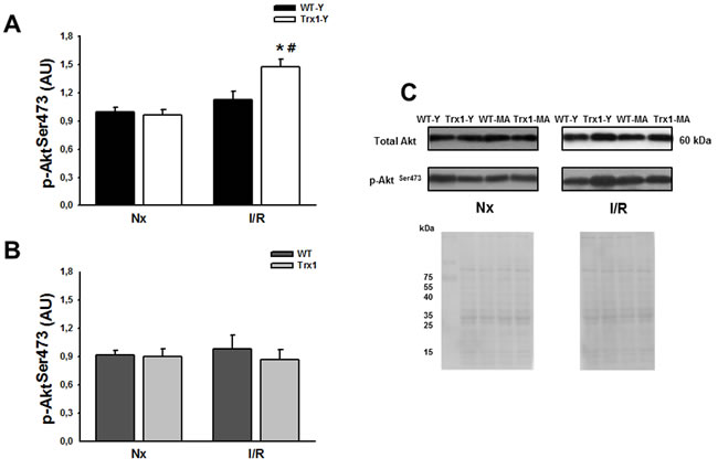 Akt phosphorylation (Ser 473) protein expression in the cytosolic fraction of normoxic (Nx) and ischemia/reperfusion protocols (I/R) in young (Panel A) and middle-aged (Panel B) mice.