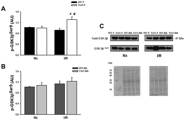 pGSK-3&#x3b2; Ser 9 protein expression in the cytosolic fraction of normoxic (Nx) and ischemia/reperfusion protocols (I/R) in young (Panel A) and middle-aged (Panel B) mice.