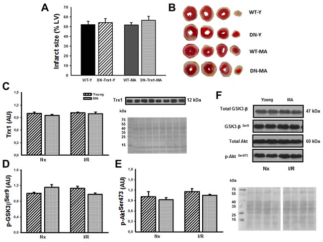 We showed DN-Trx1 mice results in order to confirm that the cardioprotection conferred by Trx1 involves Akt and GSK-3&#x3b2; inhibition/phosphorylation.