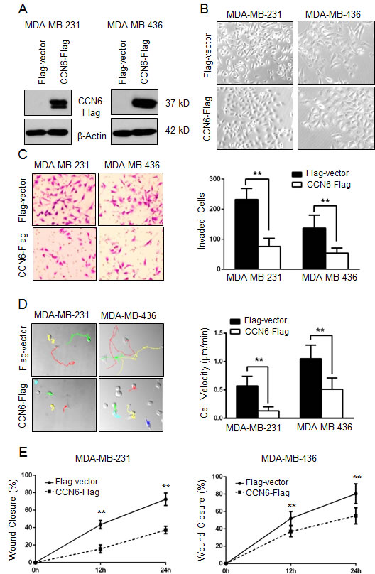 CCN6 overexpression induces phenotypic changes towards mesenchymal to epithelial transition (MET) and decreases breast cancer cell invasion and motility.