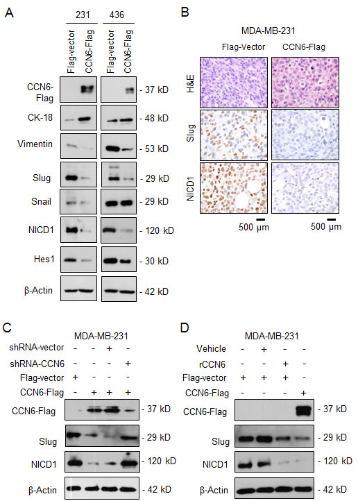CCN6 regulates the expression of Slug and Notch1 signaling pathway.