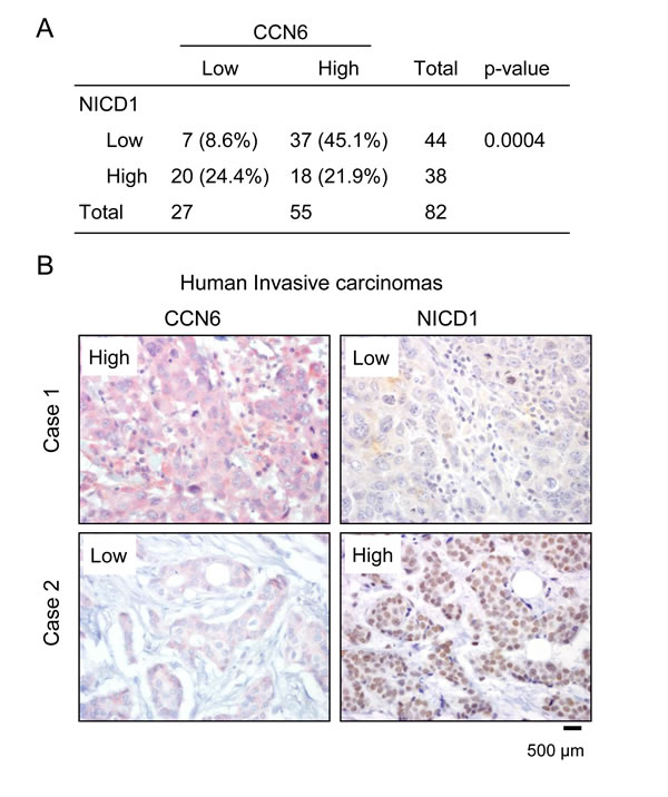 CCN6 expression is inversely associated with NICD1 in human breast cancer tissues.