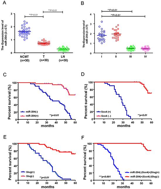 The miR-204lowSox4highSlughigh signature predicts poor survival in OSCC patients.