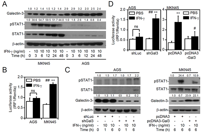 Decreasing or increasing galectin-3 expression interferes with interferon (IFN)-&#x03B3; signaling.